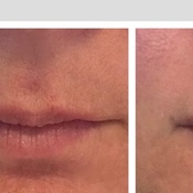 Photo submitted by Jessica