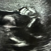 Photo submitted by Guest