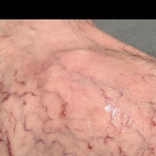 Photo submitted by Drew