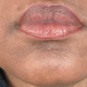 Photo submitted by yvette